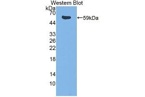 Western blot analysis of the recombinant protein. (ITK 抗体  (AA 368-625))