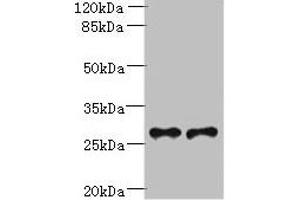 Western blot All lanes: Trem2 antibody at 6 μg/mL Lane 1: Mouse liver tissue Lane 2: THP-1 whole cell lysate Secondary Goat polyclonal to rabbit IgG at 1/10000 dilution Predicted band size: 25, 28 kDa Observed band size: 28 kDa (TREM2 抗体  (AA 19-171))