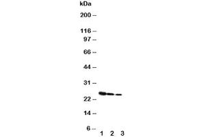 Western blot testing of Growth Hormone antibody and Lane 1:  Recombinant rat GH protein 10ng (Growth Hormone 1 抗体  (AA 27-216))