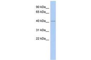 Image no. 1 for anti-Lamin Tail Domain-Containing Protein 1 (LMNTD1) (C-Term) antibody (ABIN6743701) (LMNTD1/IFLTD1 抗体  (C-Term))