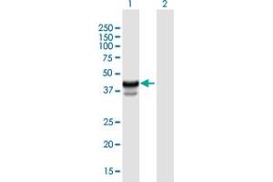 Western Blot analysis of HPR expression in transfected 293T cell line by HPR MaxPab polyclonal antibody. (HPR 抗体  (AA 1-348))