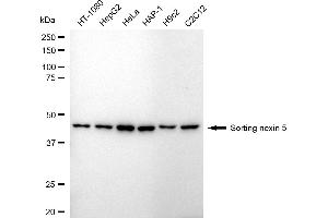 anti-Sorting Nexin 5 (SNX5) antibody
