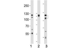 Western blot analysis of lysate from (1) HeLa, (2) K562 and (3) T47D cell line using FGFR2 antibody at 1:1000.