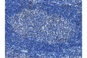 Immunohistochemical staining of paraffin-embedded Human lymph node tissue using anti-IVD mouse monoclonal antibody. (IVD 抗体)