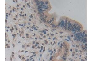 Immunohistochemistry (IHC) image for anti-Nucleoporin 85kDa (NUP85) (AA 418-653) antibody (ABIN7443359)