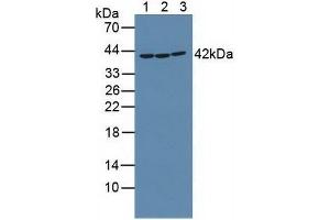 Western blot analysis of (1) Mouse Placenta Tissue, (2) Rat Placenta Tissue and (3) Human K562 Cells. (RIPK2 抗体  (AA 432-540))