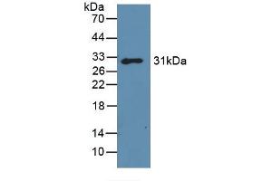 Detection of Recombinant GAL3, Mouse using Polyclonal Antibody to Galectin 3 (GAL3) (Galectin 3 抗体)