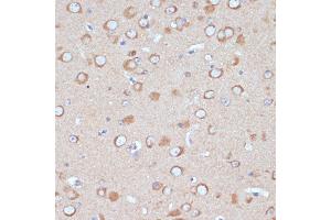 Immunohistochemistry (IHC) image for anti-Coatomer Protein Complex, Subunit gamma 2 (COPG2) (AA 542-871) antibody (ABIN7266425)