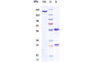 Anti-SCN9a / Nav1.