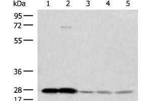 Western blot analysis of Human cerebella tissue Human cerebrum tissue Human skin tissue NIH/3T3 cell SKOV3 cell lysates using OVOL2 Polyclonal Antibody at dilution of 1:350 (OVOL2 抗体)
