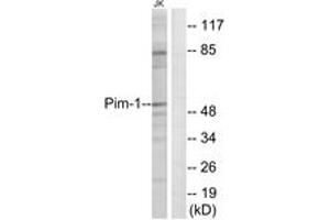 Western blot analysis of extracts from Jurkat cells, using Pim-1 (Ab-309) Antibody. (PIM1 抗体  (AA 281-330))