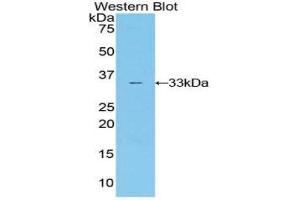 Western Blotting (WB) image for anti-Interleukin 20 Receptor alpha (IL20RA) (AA 268-538) antibody (ABIN1859400) (IL20RA 抗体  (AA 268-538))
