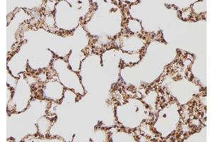 ABIN6274169 at 1/100 staining Rat lung tissue by IHC-P. (TPT1 抗体  (Internal Region))