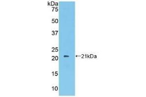 Detection of Recombinant PROS, Human using Polyclonal Antibody to Protein S (PROS) (PROS1 抗体  (AA 481-667))
