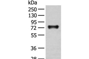 Western blot analysis of Mouse brain tissue lysate using KAT14 Polyclonal Antibody at dilution of 1:300 (KAT14 抗体)