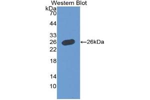Western blot analysis of the recombinant protein. (Growth Hormone 1 抗体  (AA 28-217))