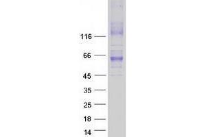 Western Blotting (WB) image for Solute Carrier Family 30 (Zinc Transporter), Member 1 (SLC30A1) protein (Myc-DYKDDDDK Tag) (ABIN2735902)