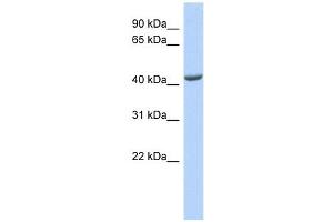 ST3GAL4 antibody used at 1 ug/ml to detect target protein. (ST3GAL4 抗体  (Middle Region))