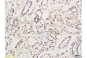 Formalin-fixed and paraffin embedded: rat brain tissue labeled with Anti-MGMT Polyclonal Antibody (ABIN730768), Unconjugated at 1:200, followed by conjugation to the secondary antibody and DAB staining (MGMT 抗体  (AA 101-207))
