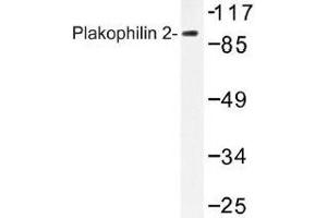Image no. 1 for anti-Plakophilin 2 (PKP2) antibody (ABIN317928) (Plakophilin 2 抗体)