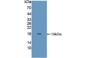 Detection of Recombinant FABP6, Human using Polyclonal Antibody to Fatty Acid Binding Protein 6, Ileal (FABP6) (FABP6 抗体  (AA 1-128))
