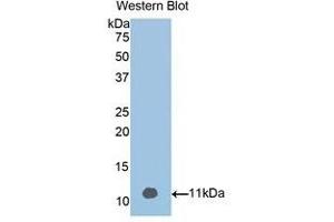 Western Blotting (WB) image for anti-Vitamin D-Binding Protein (GC) (AA 395-473) antibody (ABIN1858609) (Vitamin D-Binding Protein 抗体  (AA 395-473))