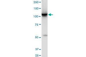 HK2 monoclonal antibody (M01), clone 4H1. (Hexokinase 2 抗体  (AA 818-917))