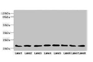 Western blot All lanes: RAB23 antibody at 3. (RAB23 抗体  (AA 1-237))