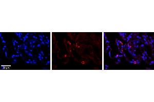 Rabbit Anti-PARL Antibody     Formalin Fixed Paraffin Embedded Tissue: Human Lung Tissue  Observed Staining: Cytoplasmic in alveolar type I cells  Primary Antibody Concentration: 1:100  Other Working Concentrations: 1/600  Secondary Antibody: Donkey anti-Rabbit-Cy3  Secondary Antibody Concentration: 1:200  Magnification: 20X  Exposure Time: 0. (PARL 抗体  (N-Term))