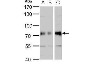 WB Image DMPK antibody detects DMPK protein by western blot analysis. (DMPK 抗体  (Center))