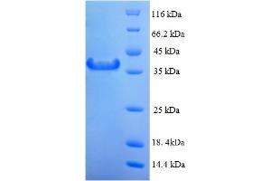 MAD2 Mitotic Arrest Deficient-Like 1 (Yeast) (MAD2L1) (AA 2-205) protein (His-SUMO Tag)