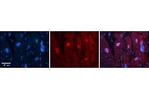Rabbit Anti-Arih2 Antibody  Catalog Number: ARP57936_P050 Formalin Fixed Paraffin Embedded Tissue: Human Adult heart  Observed Staining: Nuclear Primary Antibody Concentration: 1:100 Secondary Antibody: Donkey anti-Rabbit-Cy2/3 Secondary Antibody Concentration: 1:200 Magnification: 20X Exposure Time: 0. (ARIH2 抗体  (C-Term))