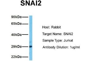 Host: Rabbit Target Name: SNAI2 Sample Tissue: Human Jurkat Antibody Dilution: 1. (SLUG 抗体  (Middle Region))