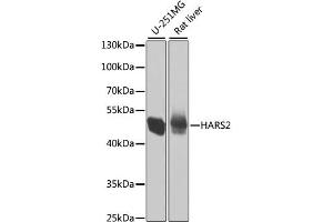 Western blot analysis of extracts of various cell lines, using HARS2 antibody. (HARS2 抗体)