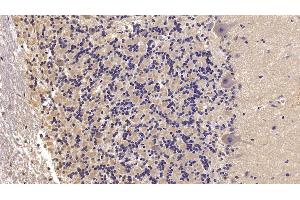 Detection of SEMA5B in Human Cerebellum Tissue using Monoclonal Antibody to Semaphorin 5B (SEMA5B) (SEMA5B 抗体  (AA 36-602))