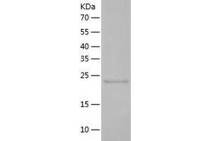 Western Blotting (WB) image for Granzyme K (Granzyme 3, Tryptase II) (GZMK) (AA 27-264) protein (His-IF2DI Tag) (ABIN7123199)