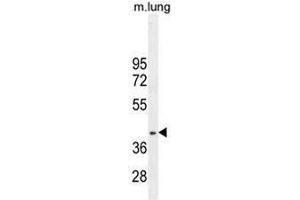 RNF215 Antibody (C-term) western blot analysis in mouse lung tissue lysates (35µg/lane). (RNF215 抗体  (C-Term))