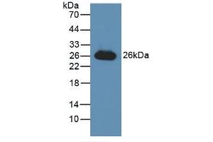 Figure. (GSTA3 抗体  (AA 1-222))