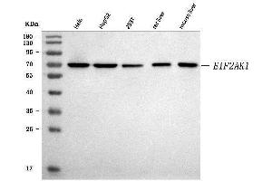 Western blot analysis of EIF2AK1 using anti-EIF2AK1 antibody (ABIN7601508).