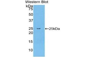 Western blot analysis of the recombinant protein. (CELA1 抗体  (AA 44-259))