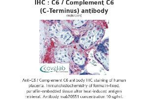Image no. 1 for anti-Complement Component 6 (C6) antibody (ABIN1723410) (C6 抗体)