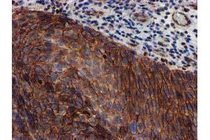 Image no. 2 for anti-Makorin Ring Finger Protein 1 (MKRN1) antibody (ABIN1499486) (MKRN1 抗体)