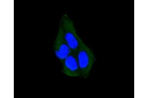 Immunofluorescence analysis of HeLa cells using ARRB1 antibody (ABIN5996907). (beta Arrestin 1 抗体)