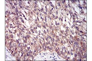 Immunohistochemistry (IHC) image for anti-DIS3-Like Exonuclease 2 (DIS3L2) (AA 27-250) antibody (ABIN1724900)