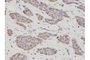 Immunohistochemistry (IHC) image for anti-Thymopoietin (TMPO) antibody (ABIN1875122) (Thymopoietin 抗体)