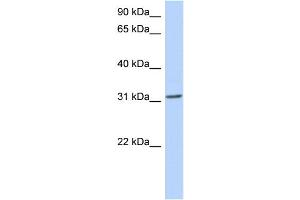 WB Suggested Anti-GSC Antibody Titration: 0. (GSC 抗体  (N-Term))