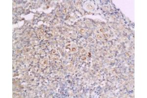 Immunohistochemistry (Paraffin-embedded Sections) (IHC (p)) image for anti-Cyclin D2 (CCND2) (AA 161-288) antibody (ABIN738366)