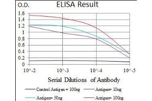 Black line: Control Antigen (100 ng), Purple line: Antigen(10 ng), Blue line: Antigen (50 ng), Red line: Antigen (100 ng), (DNAL4 抗体  (AA 1-105))