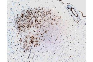 Immunohistochemical staining of neurons and endothelial cells from blood vessels (formalin-fixed, citrate buffer pre-treatment, 10X). (PTGS2 抗体  (AA 368-604))