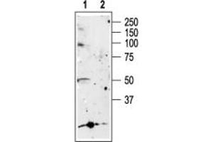 anti-Purinergic Receptor P2X, Ligand-Gated Ion Channel, 5 (P2RX5) (AA 437-455), (Intracellular) antibody